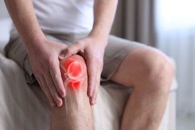 Image of Arthritis. Man suffering from knee pain on bed indoors, closeup. Illustration of joint inflammation on his leg