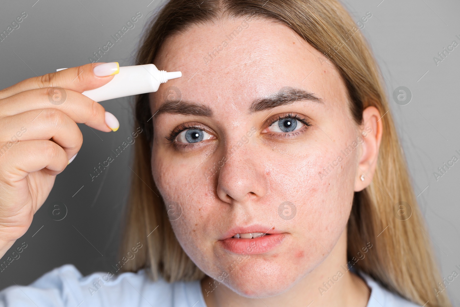 Photo of Woman applying cream onto face on grey background. Acne treatment