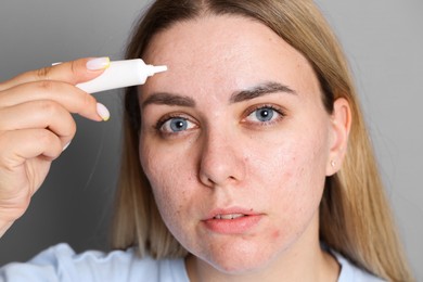 Photo of Woman applying cream onto face on grey background. Acne treatment