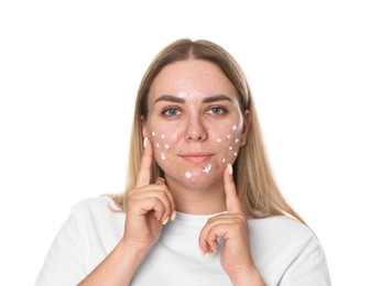 Photo of Woman applying cream onto face on white background. Acne treatment