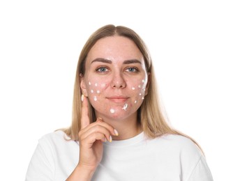 Photo of Woman applying cream onto face on white background. Acne treatment