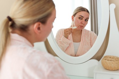 Photo of Woman applying cream onto face near mirror indoors. Acne treatment