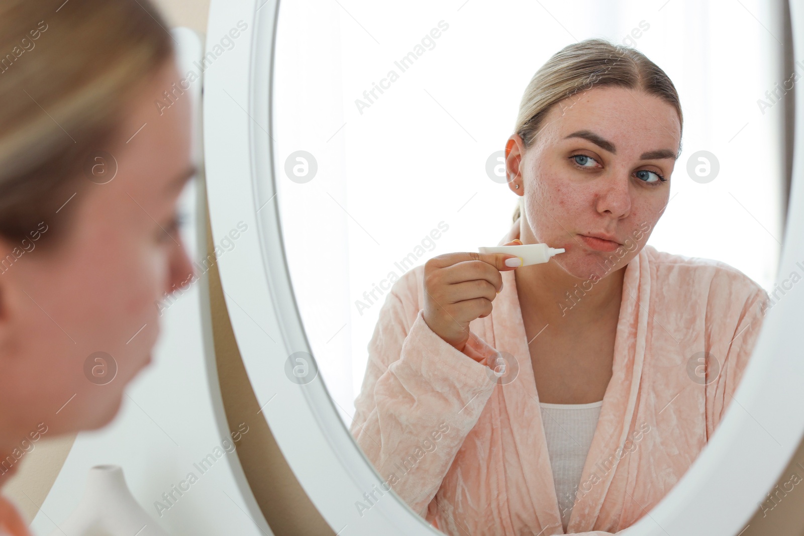 Photo of Woman applying cream onto face near mirror indoors. Acne treatment
