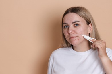 Photo of Woman applying cream onto face on beige background, space for text. Acne treatment