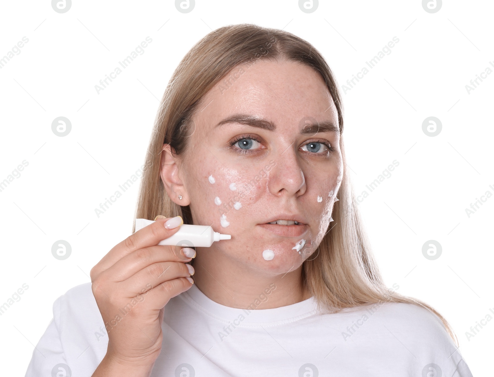 Woman applying cream onto face on white background. Acne treatment Photo of Woman applying cream onto face on white background. Acne treatment