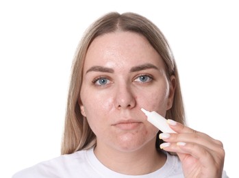 Photo of Woman applying cream onto face on white background. Acne treatment