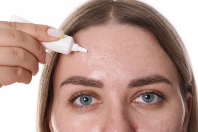 Photo of Woman applying cream onto face on white background, closeup. Acne treatment