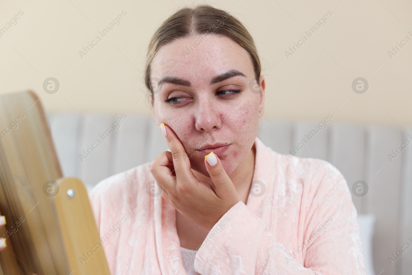 Woman with acne problem looking in mirror at home Photo of Woman with acne problem looking in mirror at home