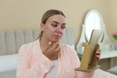 Photo of Woman with acne problem looking in mirror at home