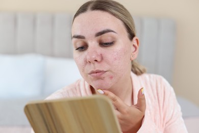 Photo of Woman with acne problem looking in mirror at home
