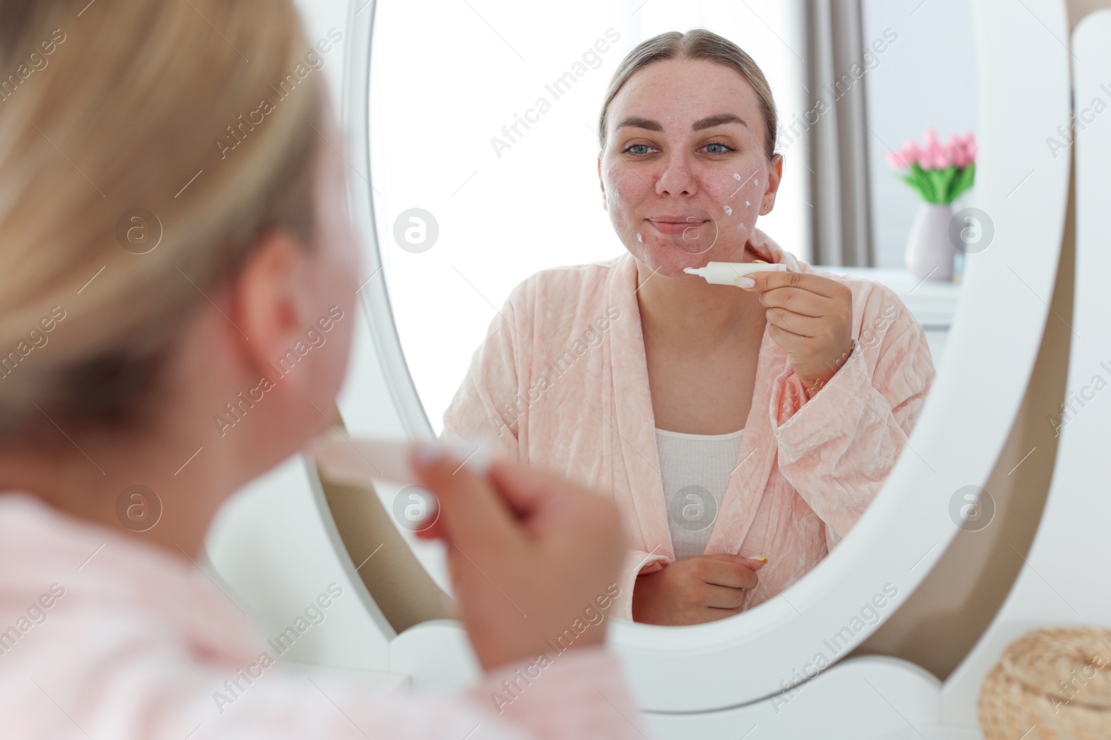Woman applying cream onto face near mirror indoors. Acne treatment Photo of Woman applying cream onto face near mirror indoors. Acne treatment