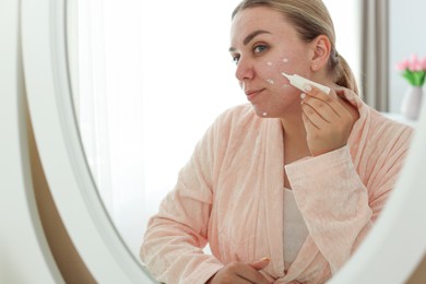 Photo of Woman applying cream onto face near mirror indoors. Acne treatment
