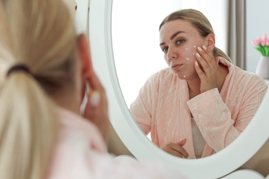 Photo of Woman applying cream onto face near mirror indoors. Acne treatment
