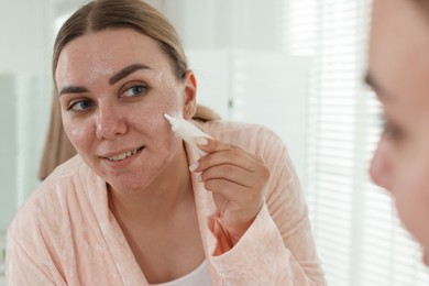 Photo of Woman applying cream onto face near mirror indoors. Acne treatment