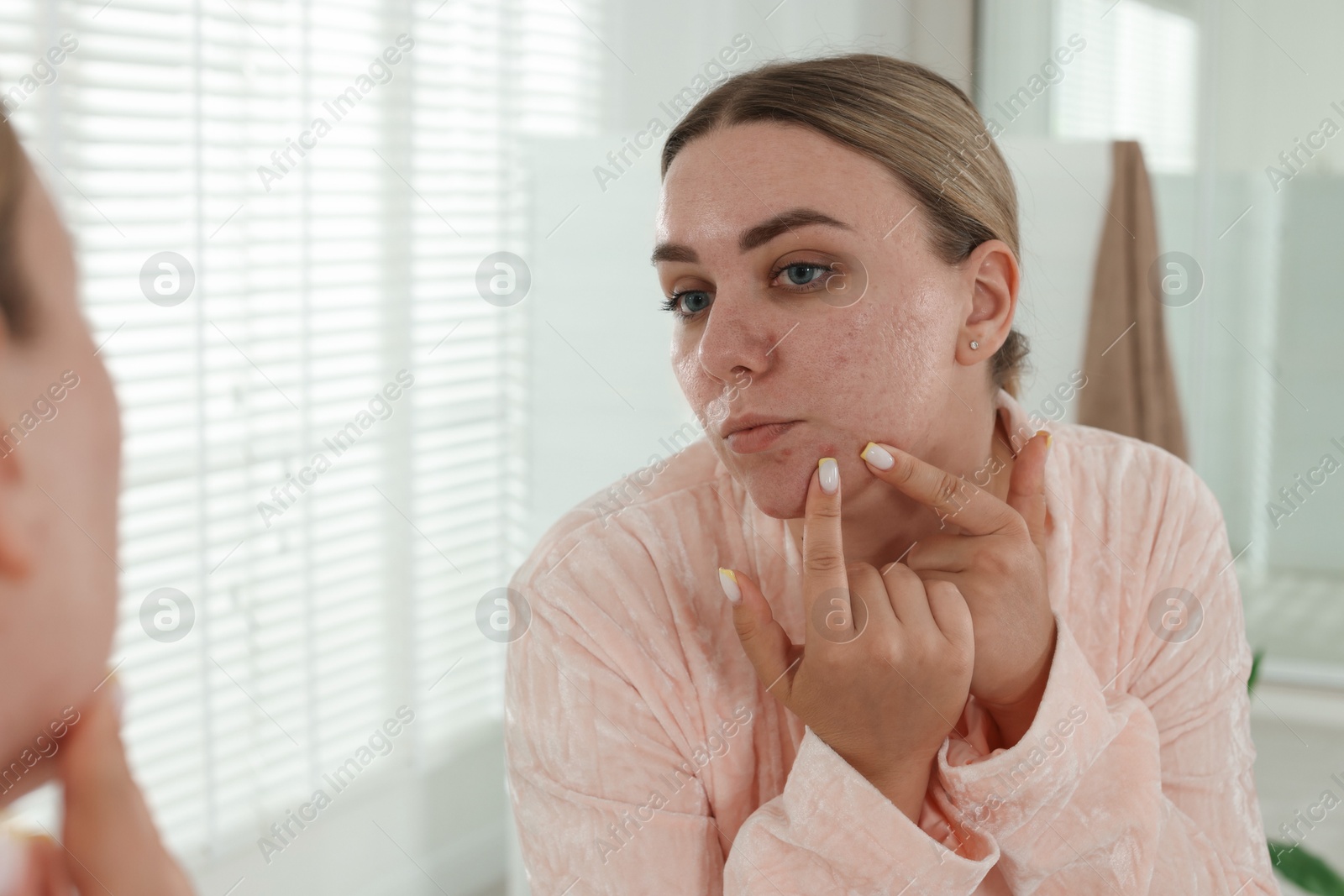 Woman popping pimple near mirror in bathroom. Acne problem Photo of Woman popping pimple near mirror in bathroom. Acne problem