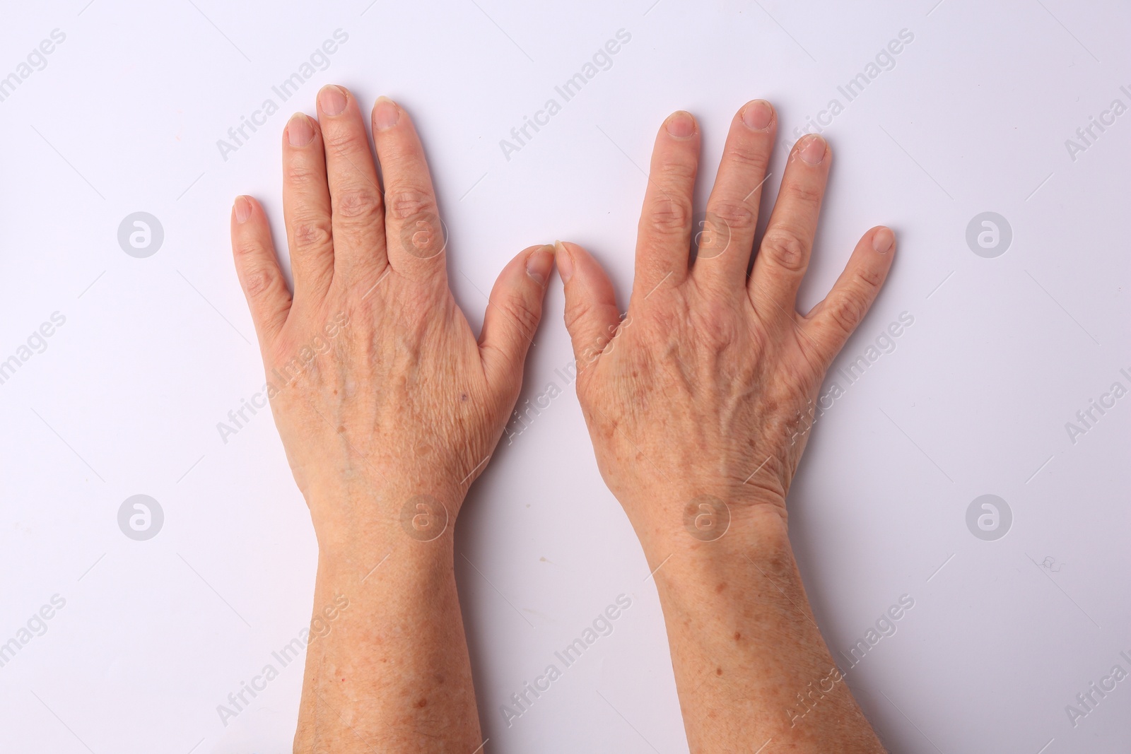 Closeup view of woman's hands with aging skin, top view Photo of Closeup view of woman's hands with aging skin, top view