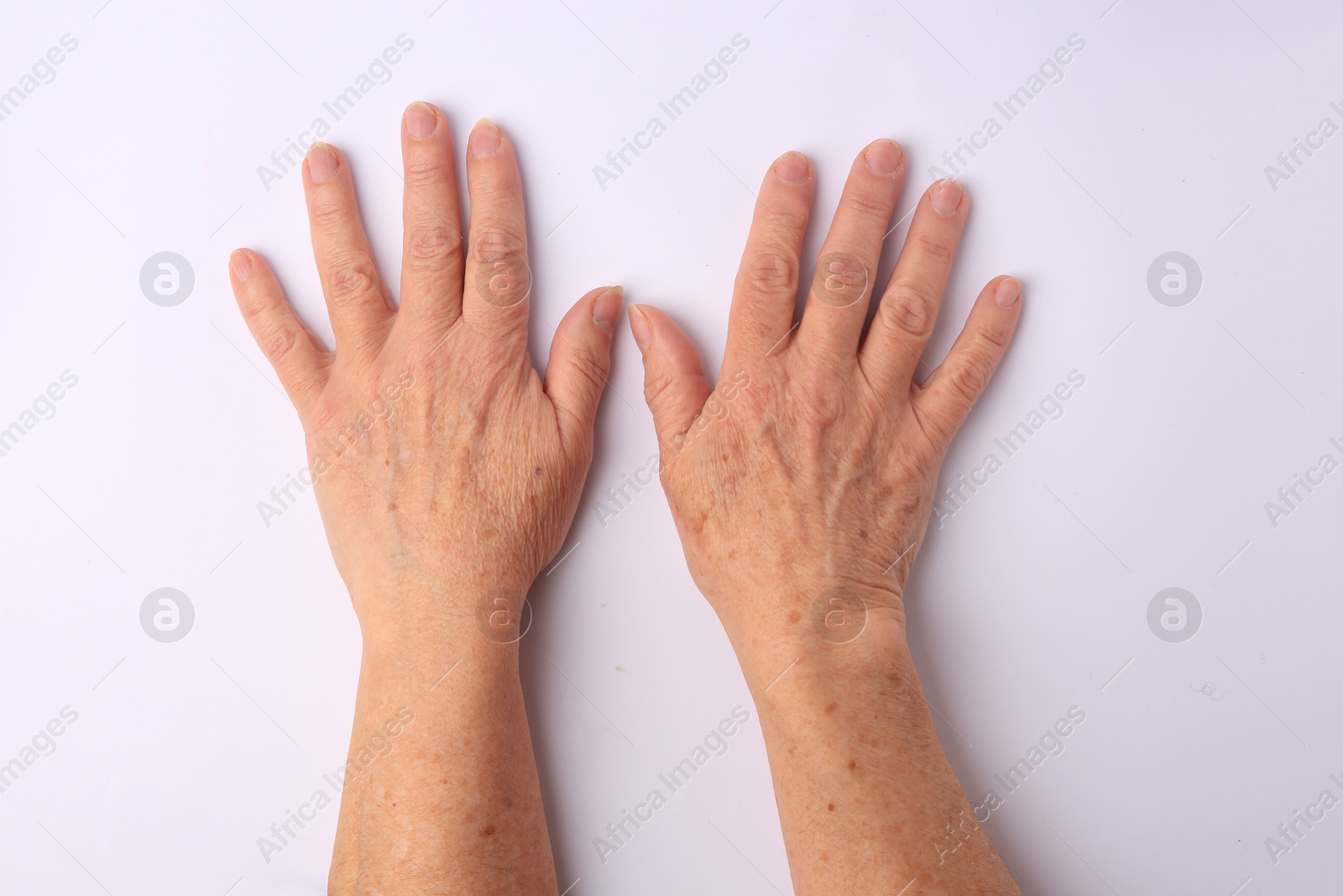 Closeup view of woman's hands with aging skin, top view Photo of Closeup view of woman's hands with aging skin, top view