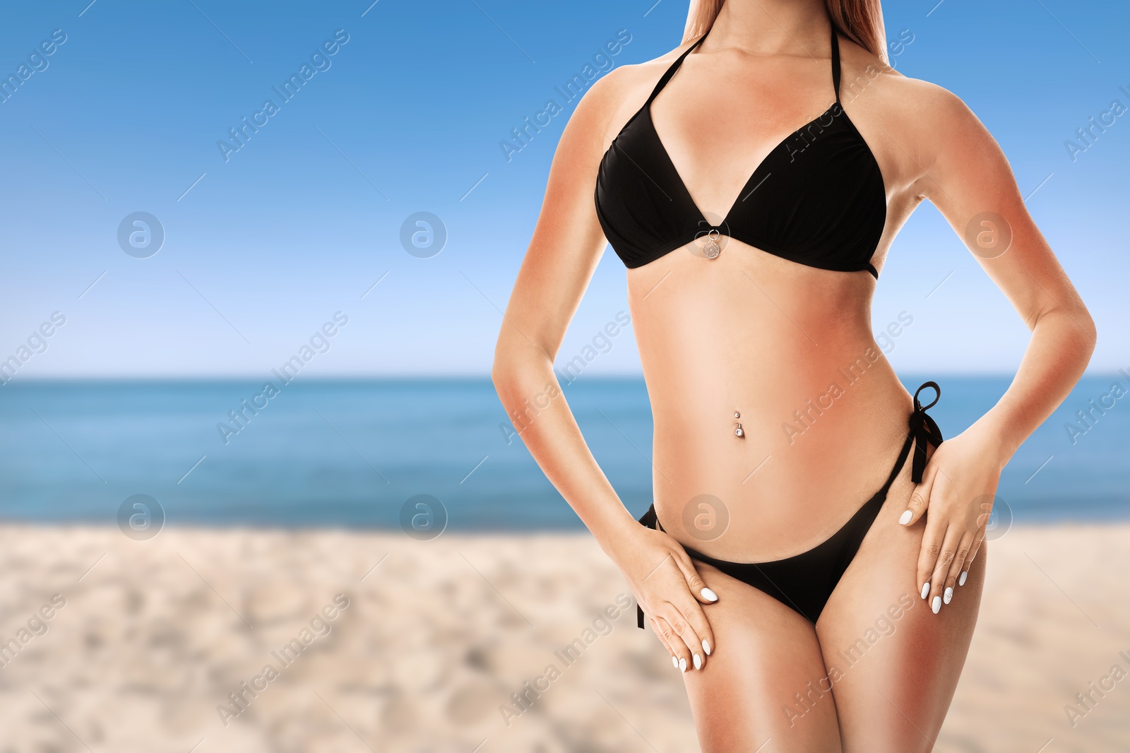 Woman with sunburns on her skin on beach, closeup Image of Woman with sunburns on her skin on beach, closeup