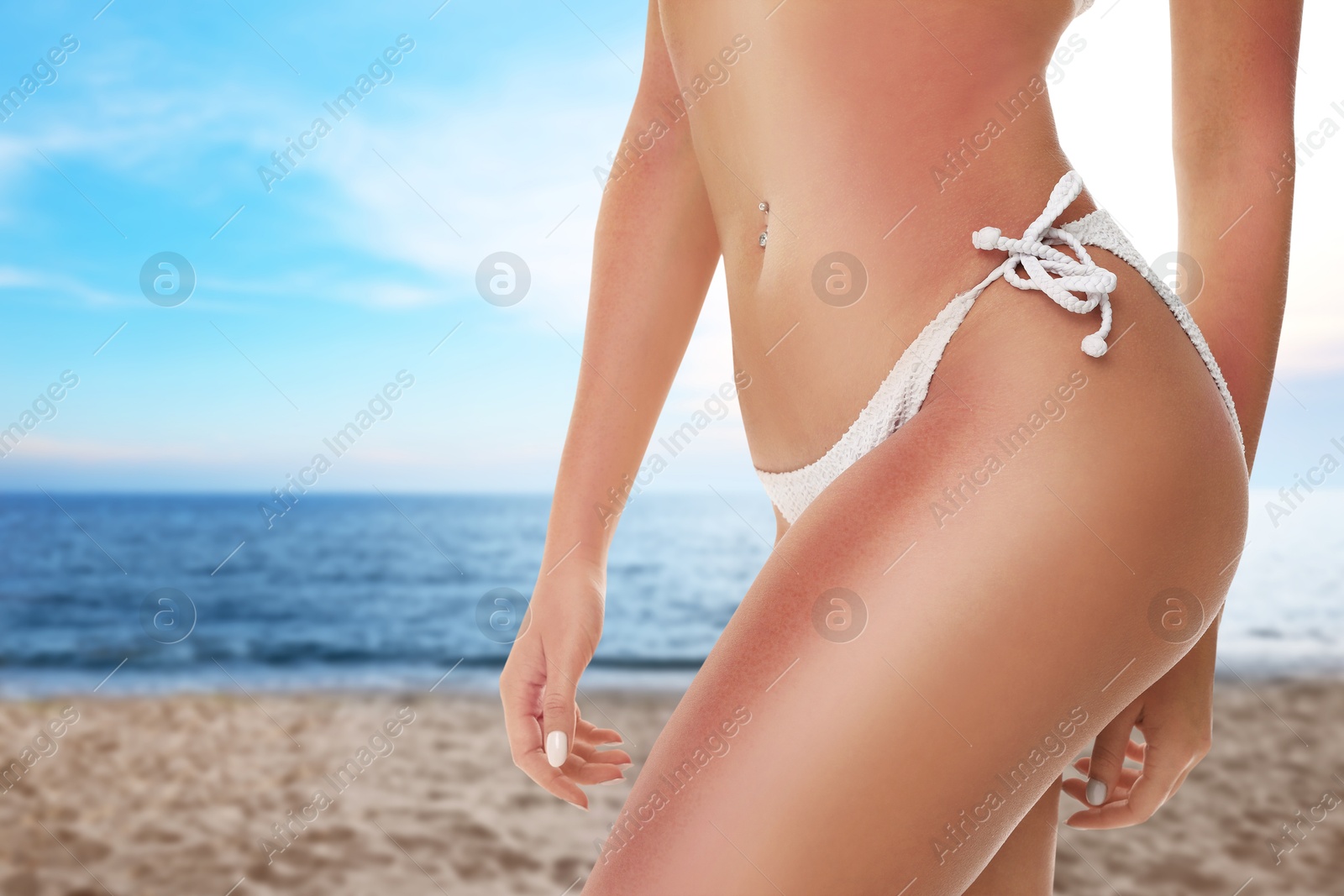 Woman with sunburns on her skin on beach, closeup Image of Woman with sunburns on her skin on beach, closeup