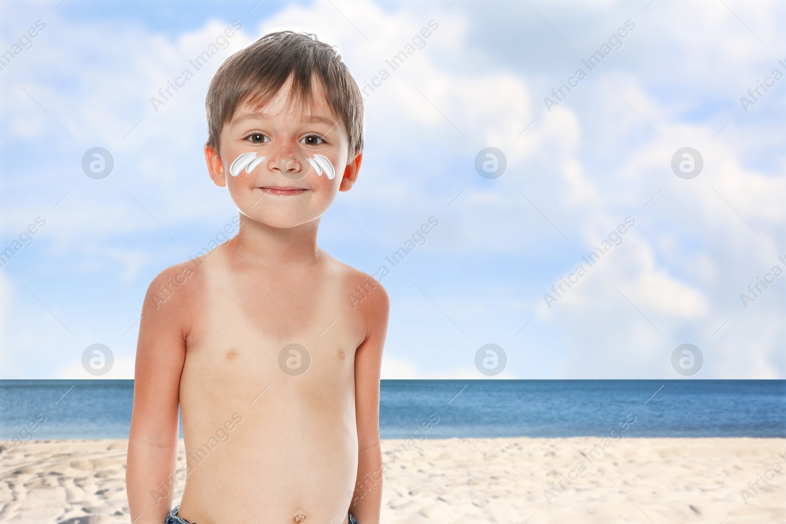 Image of Little boy with sunburned skin on beach. Soothing cream on his cheeks