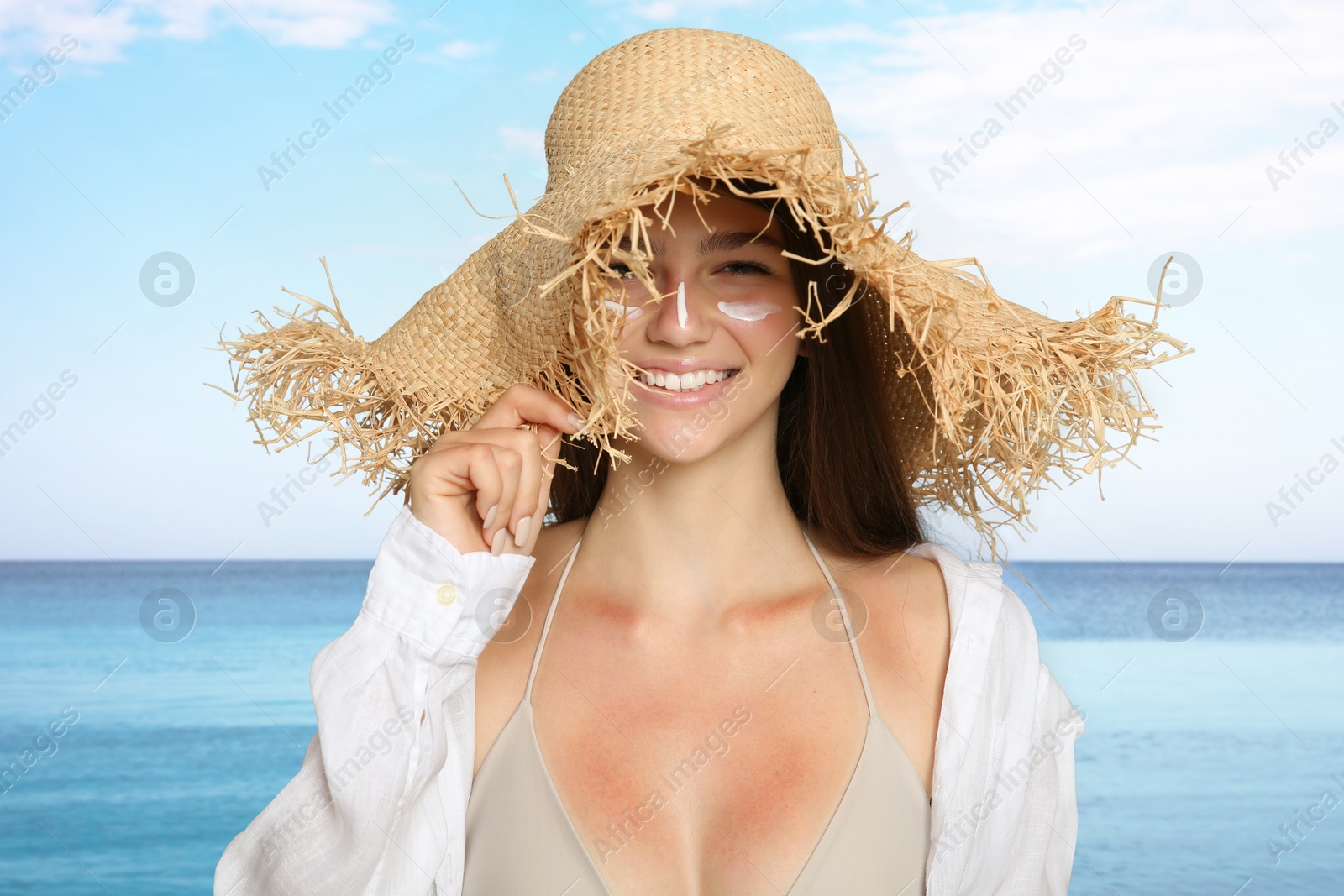 Image of Girl with sunburned skin on beach. Soothing cream on her face