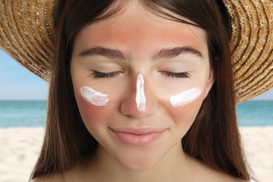Image of Girl with sunburned skin on beach, closeup. Soothing cream on her face