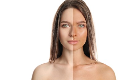 Image of Before and after suntanning. Photo of woman divided into halves on white background, space for text