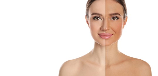 Image of Before and after suntanning. Photo of woman divided into halves on white background. Banner design with space for text