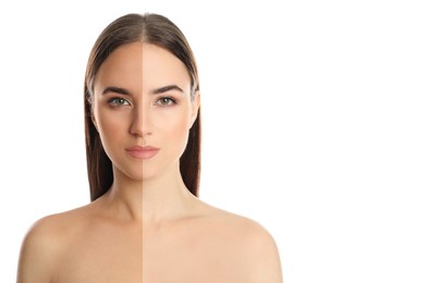 Image of Before and after suntanning. Photo of woman divided into halves on white background, space for text