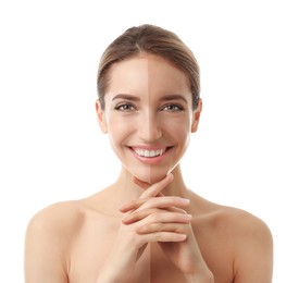 Image of Before and after suntanning. Photo of woman divided into halves on white background