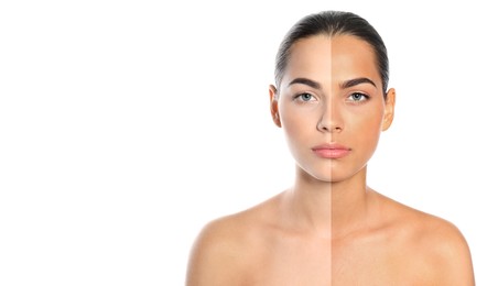 Image of Before and after suntanning. Photo of woman divided into halves on white background. Banner design with space for text