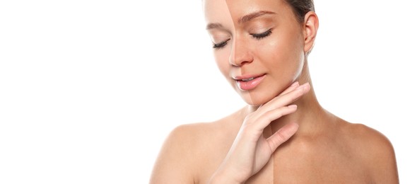 Image of Before and after suntanning. Photo of woman divided into halves on white background. Banner design with space for text
