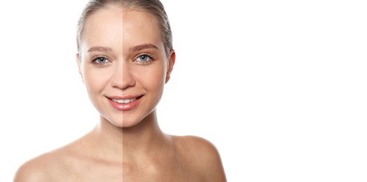 Image of Before and after suntanning. Photo of woman divided into halves on white background. Banner design with space for text