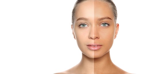 Image of Before and after suntanning. Photo of woman divided into halves on white background. Banner design with space for text