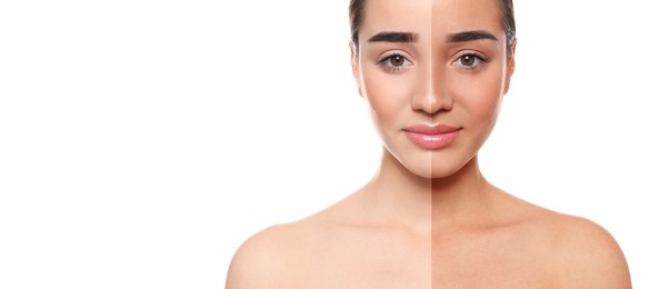Image of Before and after suntanning. Photo of woman divided into halves on white background. Banner design with space for text