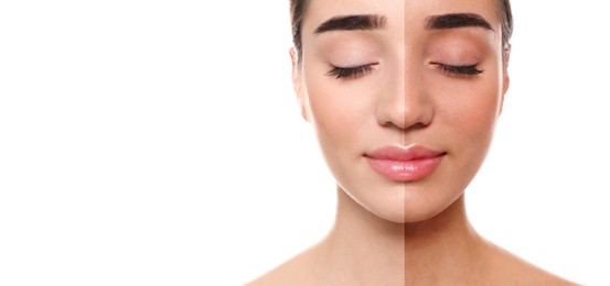Image of Before and after suntanning. Photo of woman divided into halves on white background. Banner design with space for text