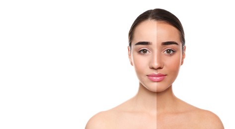 Image of Before and after suntanning. Photo of woman divided into halves on white background. Banner design with space for text