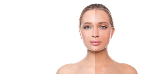 Image of Before and after suntanning. Photo of woman divided into halves on white background. Banner design with space for text