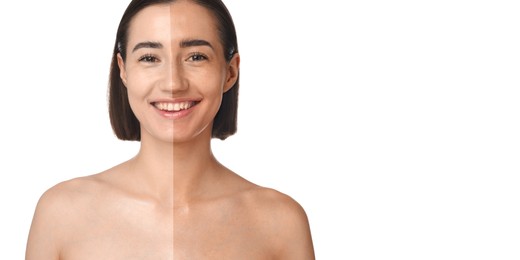Image of Before and after suntanning. Photo of woman divided into halves on white background. Banner design with space for text