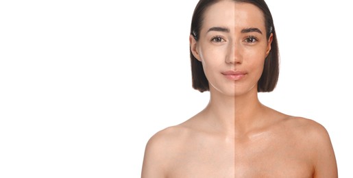 Image of Before and after suntanning. Photo of woman divided into halves on white background. Banner design with space for text