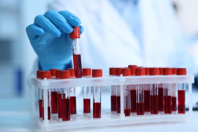 Photo of Medical analysis. Scientist working with blood sample in laboratory, selective focus