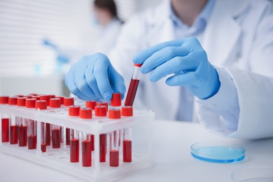 Photo of Medical analysis. Scientist working with blood sample in laboratory, selective focus