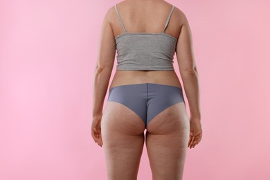 Photo of Liposuction. Woman in underwear on pink background, back view