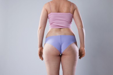 Photo of Liposuction. Woman in underwear on grey background, back view