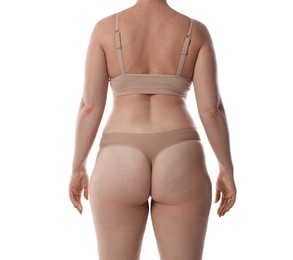 Photo of Liposuction. Woman in underwear on white background, back view