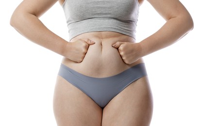 Photo of Liposuction. Woman in underwear touching her belly on white background, closeup