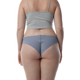 Photo of Liposuction. Woman in underwear on white background, back view