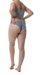 Photo of Liposuction. Woman in underwear on white background, back view
