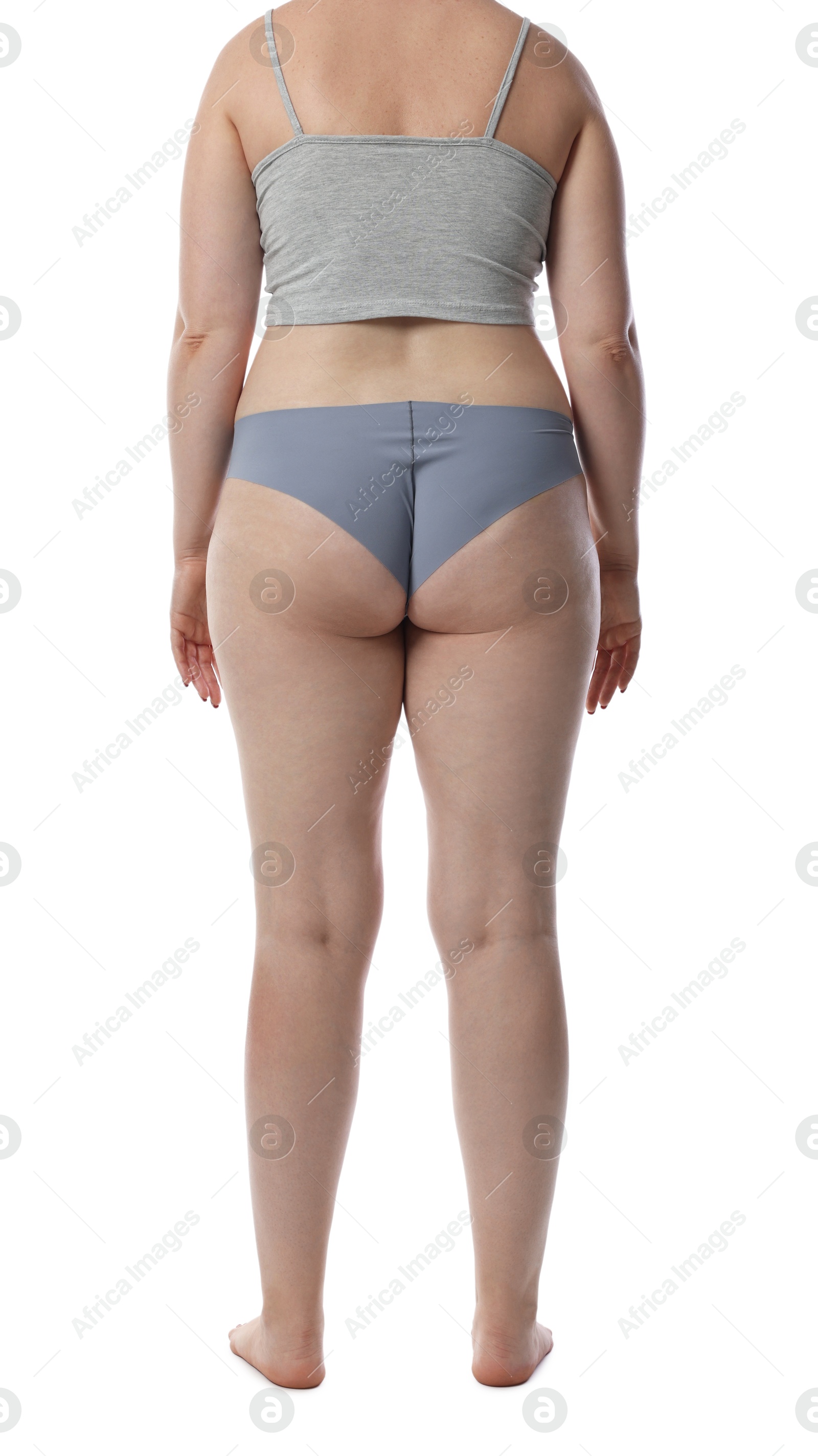 Photo of Liposuction. Woman in underwear on white background, back view