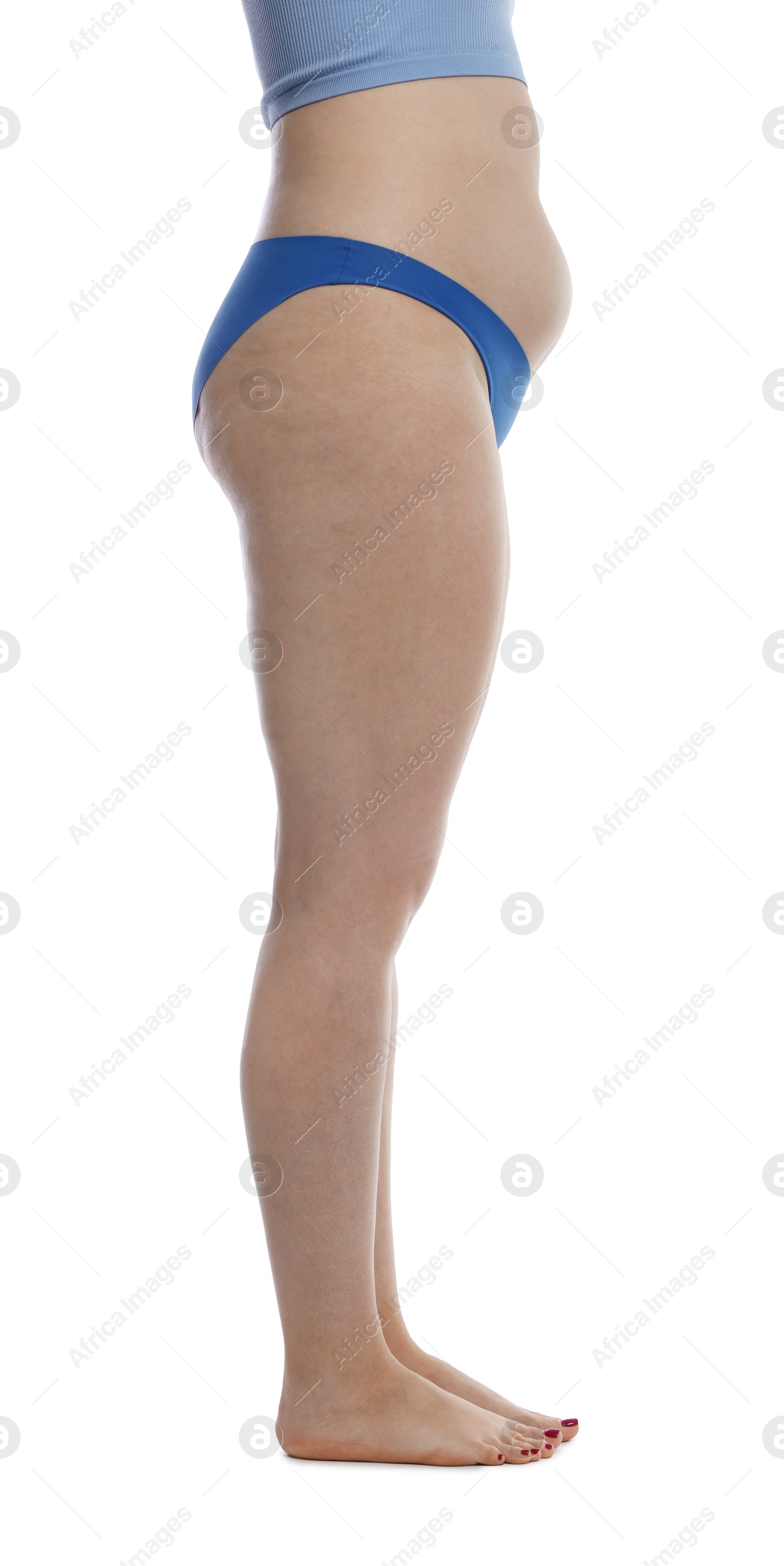 Photo of Liposuction. Woman in underwear on white background, closeup
